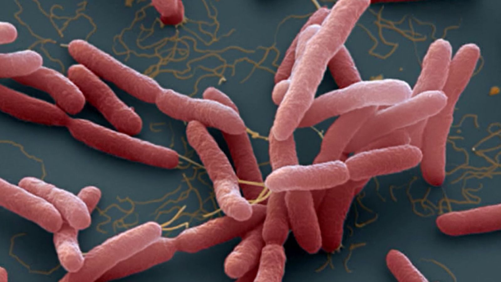 Whitmore - Vi khuẩn ăn thịt người nguy hiểm đến mức độ nào